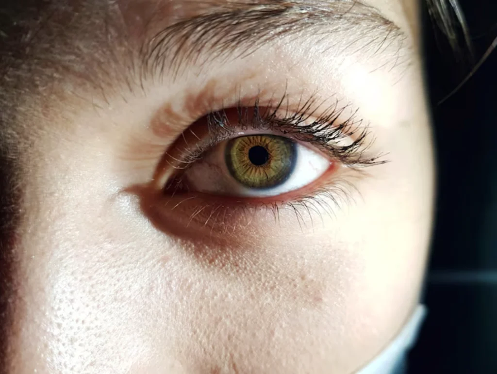 Зображення зіниці ока після вживання